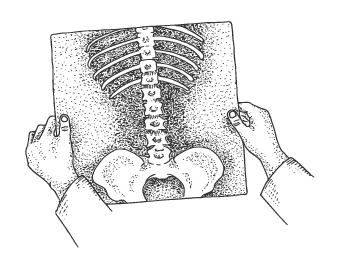 Back Pain Treatment - Queanbeyan & Canberra | Provolution Health